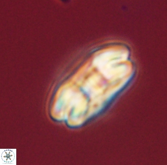 Markalius astroporus 55570