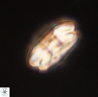 Markalius astroporus 55571