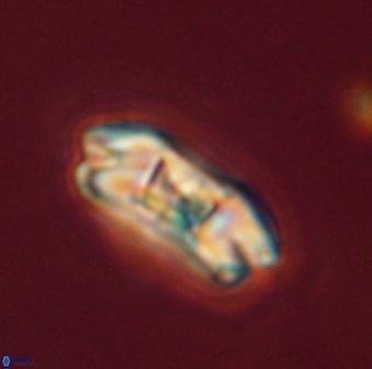 Markalius astroporus 55573