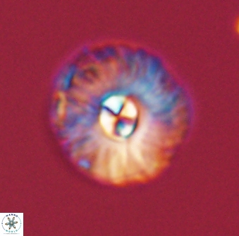 Markalius astroporus 55576