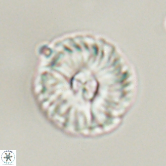 Markalius astroporus 55578