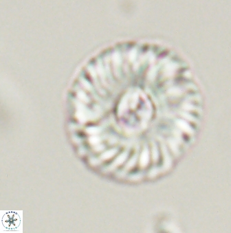 Markalius astroporus 55586