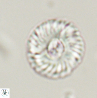 Markalius astroporus 55588