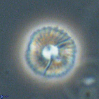 Markalius sp 67795