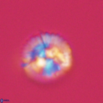 Markalius sp 67797