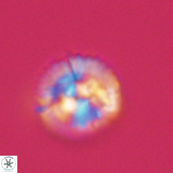 Markalius sp 67797