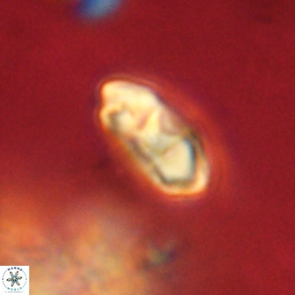Markalius walviensis VR 01309