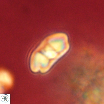 Markalius walviensis VR 01312