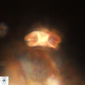 Markalius walviensis VR 01314
