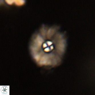 Markalius walviensis VR 01315