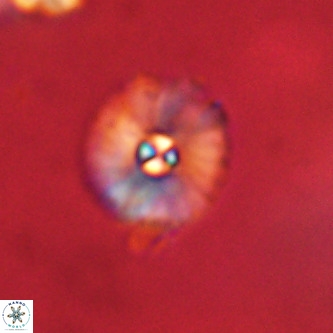 Markalius walviensis VR 01316