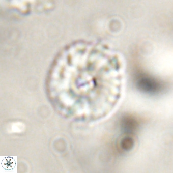 Markalius walviensis VR 01317