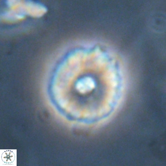 Markalius walviensis VR 01318