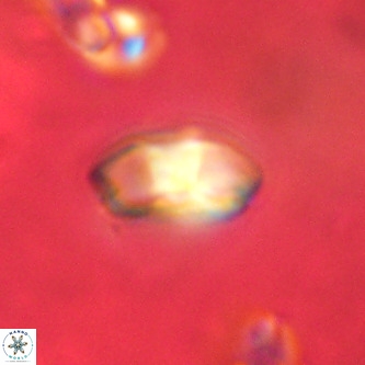 Markalius walviensis VR 01322