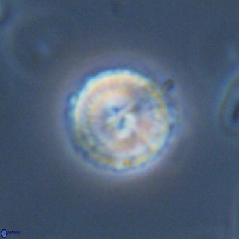 Mauriceblackia katejacovidesiae 70875