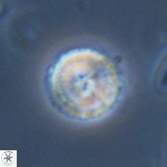 Mauriceblackia katejacovidesiae 70875
