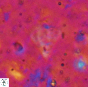 Minylitha cancellata 19451