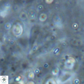 Minylitha cancellata 19455