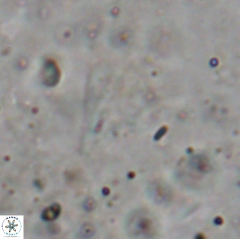 Minylitha cancellata 19456