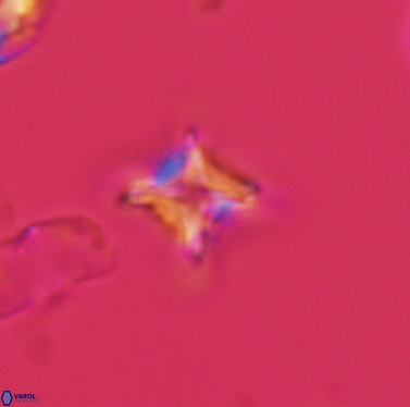 Micula cf decussata 3420