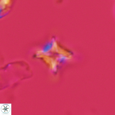 Micula cf decussata 3420