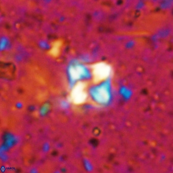 Micula decussata VR 21392