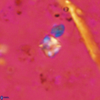 Micula lakkos VR 11184