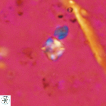 Micula lakkos VR 11184