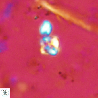 Micula lakkos VR 11185