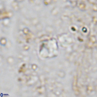 Micula lakkos VR 11187