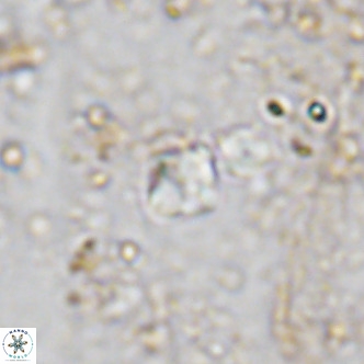Micula lakkos VR 11187