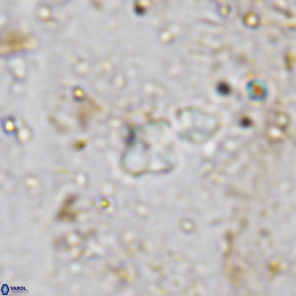 Micula lakkos VR 11188