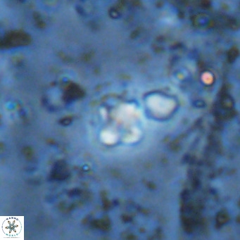 Micula lakkos VR 11189