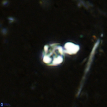 Micula lakkos VR 11182