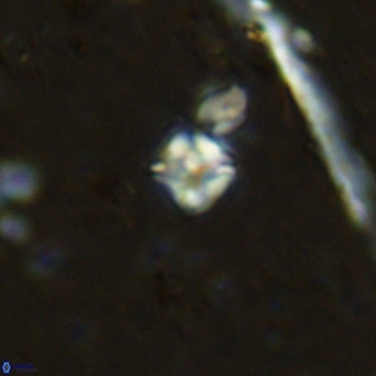 Micula lakkos VR 11183