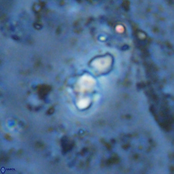 Micula lakkos VR 11190
