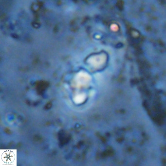 Micula lakkos VR 11190