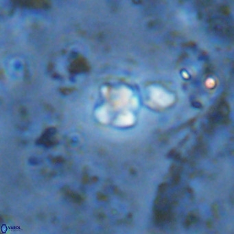 Micula lakkos VR 11191