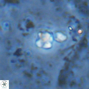 Micula lakkos VR 11191