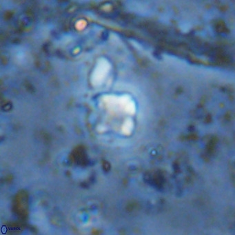 Micula lakkos VR 11192