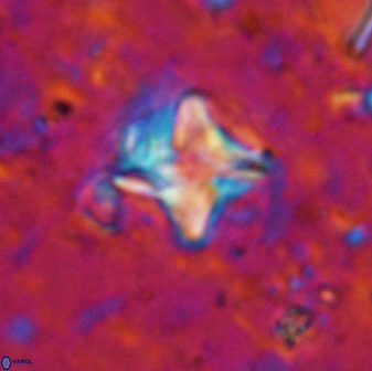 Micula vekshinae decussata 34145