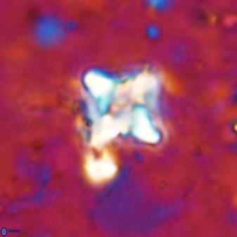 Micula vekshinae decussata 34152