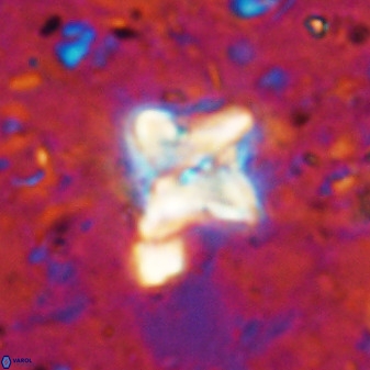 Micula vekshinae decussata 34155