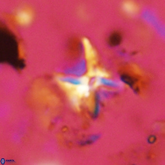 Micula vekshinae decussata VR 11430