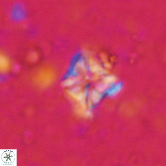 Micula vekshinae VR 21351