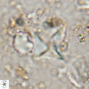 Micula vekshinae VR 21696