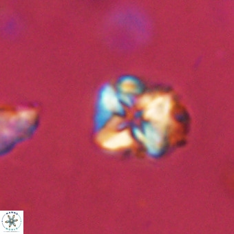 Micula vekshinae VR 22304