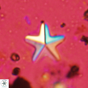 Micrantholithus bassiensis 2407