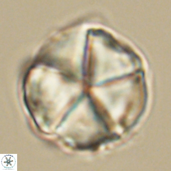 Micrantholithus disculus 67747