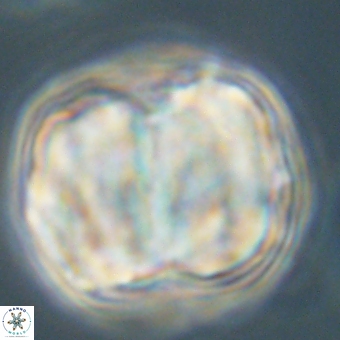 Micrantholithus disculus 67750